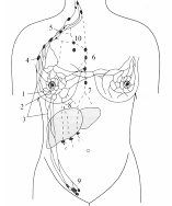 Комплексное ультразвуковое исследование в диагностике заболеваний молочной железы 4