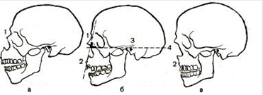 Пропорции головы человека 7